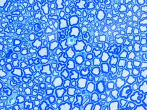 甲苯胺藍(lán)染色